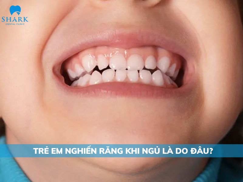 Trẻ nghiến răng khi ngủ nguyên nhân do đâu?