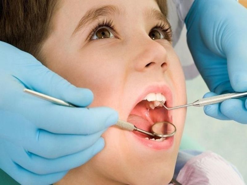 Trẻ nghiến răng thường xuyên gây mòn men răng, dẫn tới răng bị hư hỏng