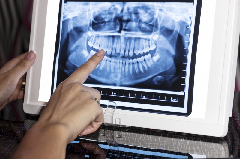 Thăm khám tổng quát giúp bác sĩ xác định sức khỏe răng miệng của khách hàng