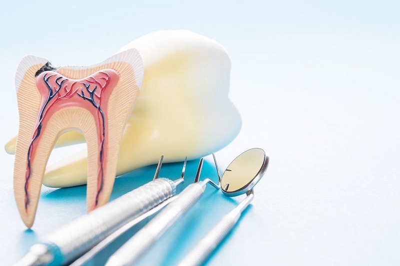 Đặt thuốc diệt tủy khiến răng đau nhức có sao không?