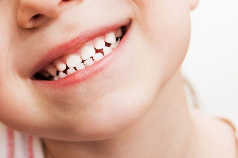 Khi bé được khoảng 3 tuổi, toàn bộ 20 chiếc răng sữa sẽ ổn định vị trí trên xương hàm