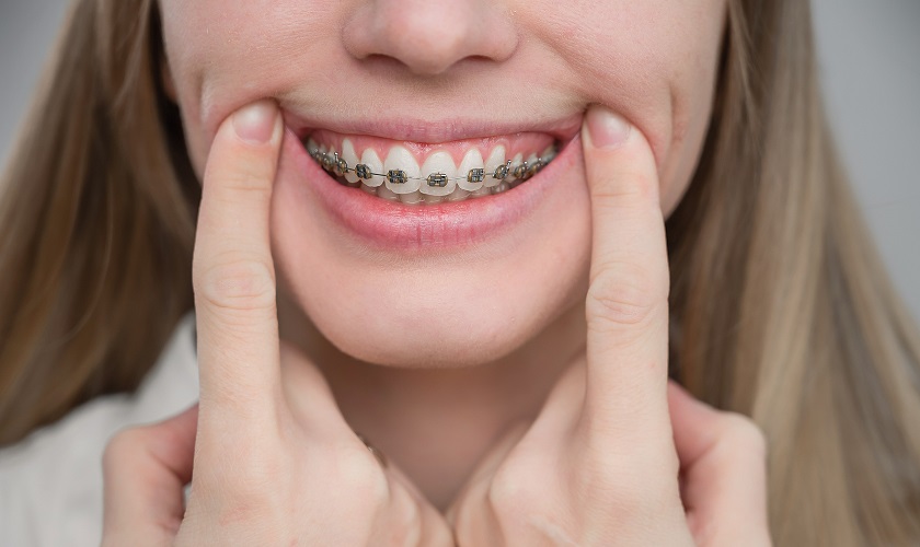 Niềng răng có thể khiến cho cơ thể giảm đi cân nặng