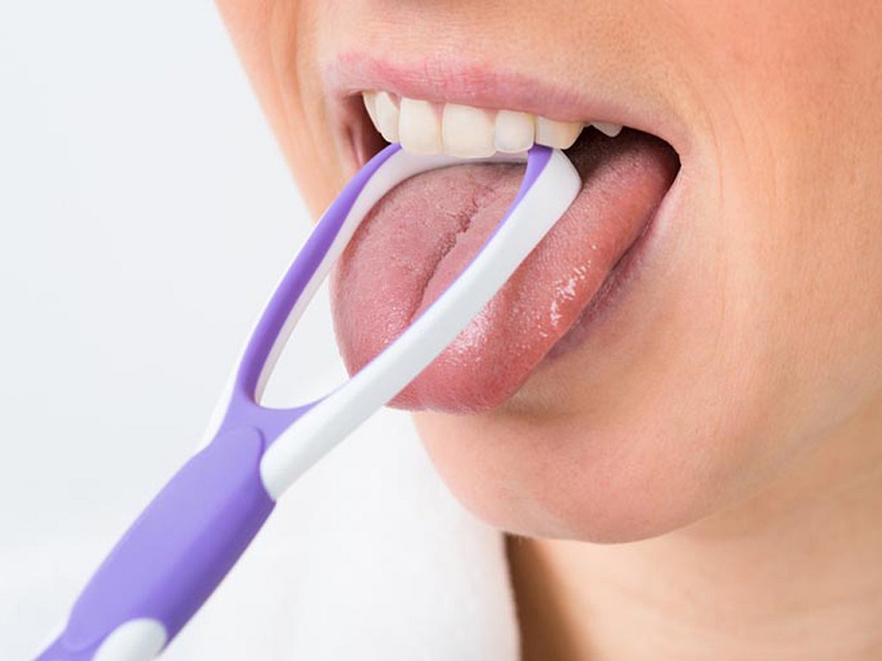 Chải mặt lưỡi để loại bỏ vị khuẩn gây hôi miệng