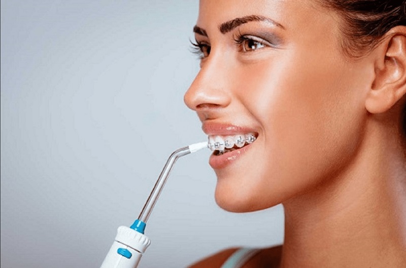 Sử dụng máy tăm nước để chăm sóc răng miệng khi niềng