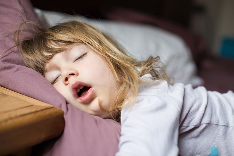 Ngủ mở miệng khiến khoang miệng bị khô, mất nước bề mặt răng và xuất hiện vết trắng đục trên răng của trẻ