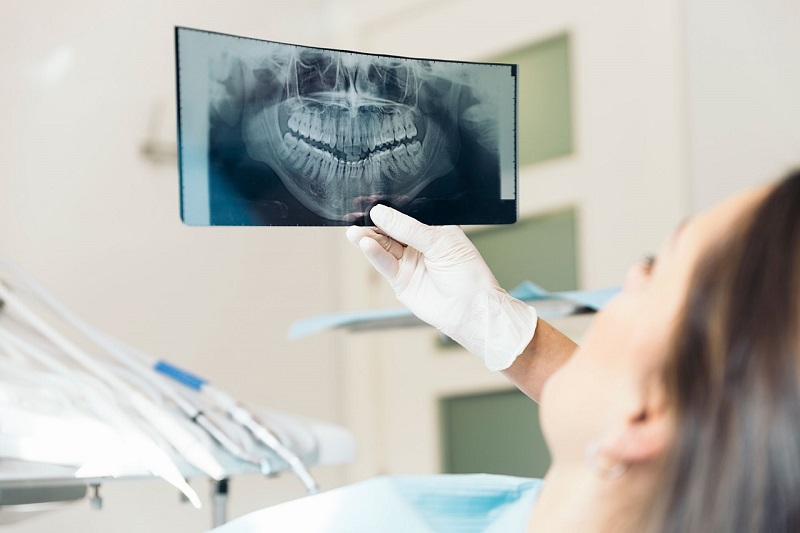 Bác sĩ phân tích kết quả chụp X-quang răng và xây dựng phác đồ điều trị