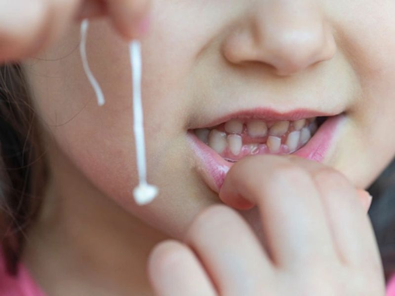 Dùng chỉ nha khoa buộc vào thân răng để nhổ răng cho bé