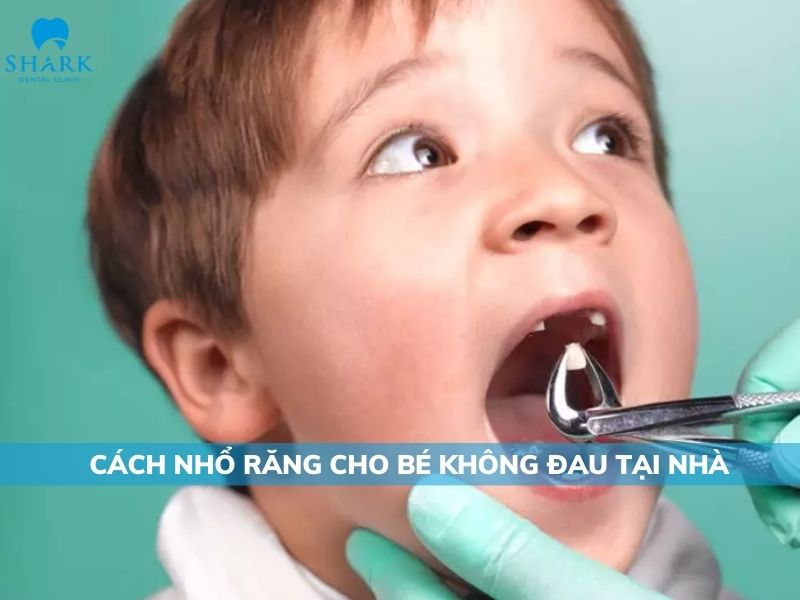 cách nhổ răng không đau cho bé