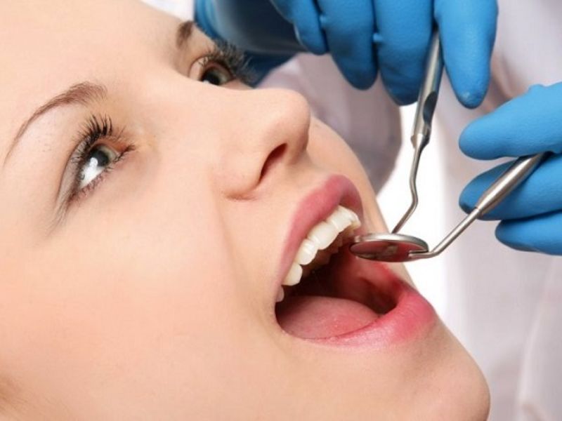 Hàn răng giúp cải thiện tình trạng răng thưa hiệu quả