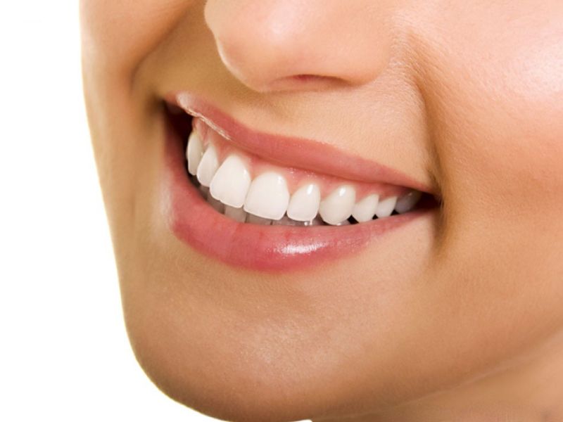 Bọc răng sứ giúp tình trạng răng thưa cải thiện và tăng tính thẩm mỹ trên gương mặt