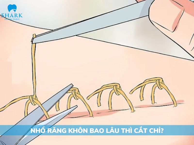 nho-rang-khon-sau-bao-lau-cat-chi