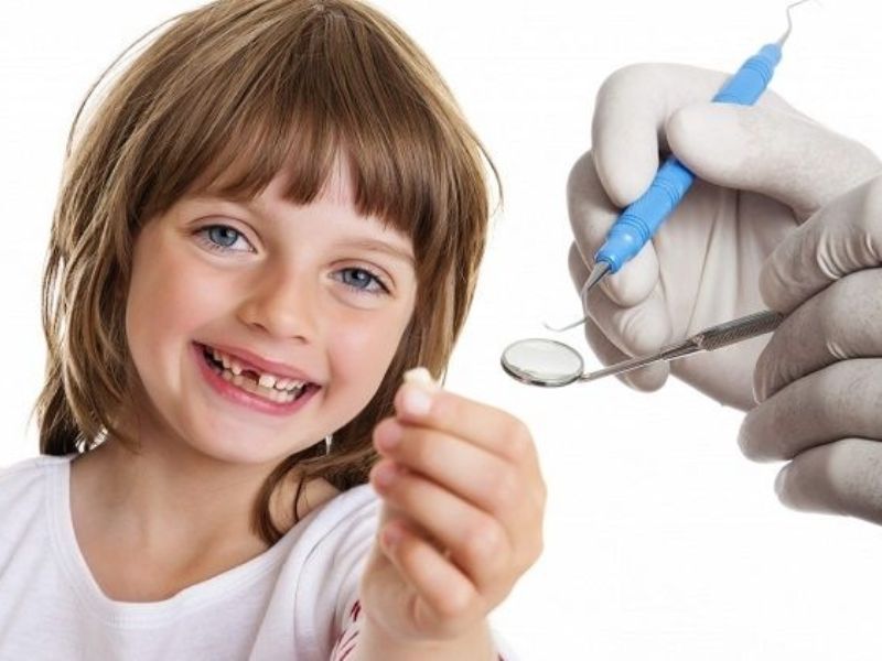 Những lưu ý mà bố mẹ cần biết khi nhổ răng sữa cho trẻ