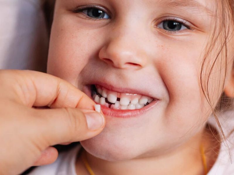 Nên cất giữ chiếc răng sữa đầu tiên để sử dụng cho tương lai như điều trị bệnh hiểm nghèo
