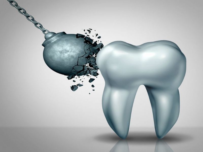 Răng bị đen ở kẽ do nguyên nhân nào?