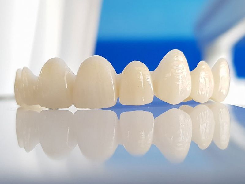 Răng Centonia có màu sắc tự nhiên giống răng thật nên đảm bảo tính thẩm mỹ cao