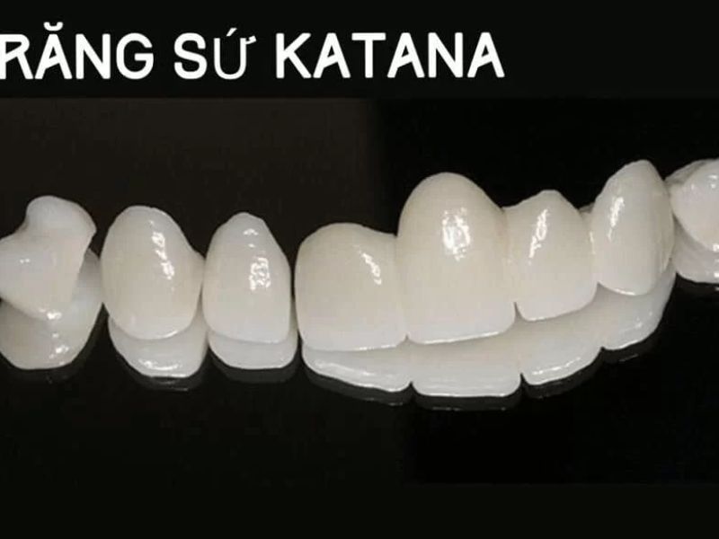 Răng sứ Katana có độ chịu lực cao nên thích hợp để làm cầu răng sứ