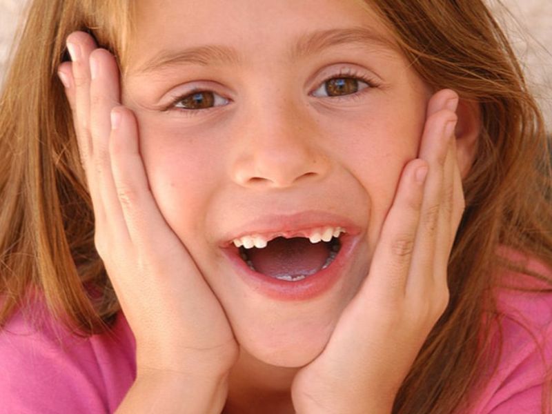 Khi trẻ 8 tuổi chưa thay răng sữa thì cần phải làm sao