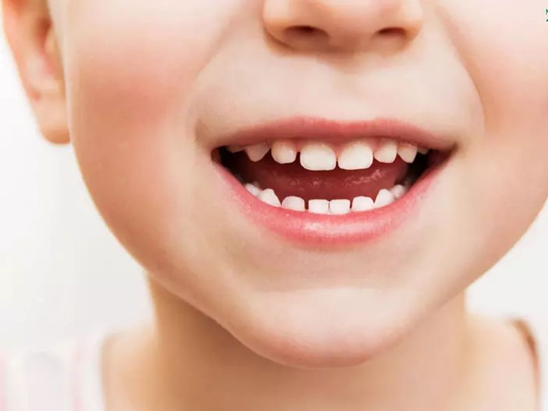 Yếu tố di truyền cũng là nguyên nhân gây ra tình trạng thay răng chậm ở bé