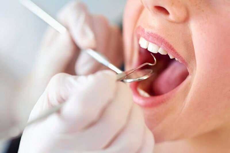 Lấy cao răng định kỳ sẽ giúp ngăn ngừa các bệnh lý răng hiệu quả