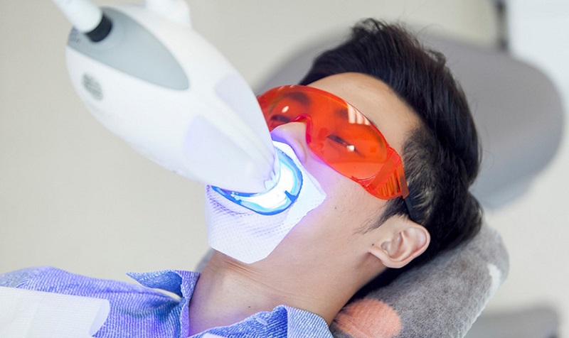 Tẩy trắng răng có tác dụng cải thiện tình trạng răng ố vàng, xỉn màu với năng lượng của ánh sáng laser và hoạt chất thuốc tẩy trắng