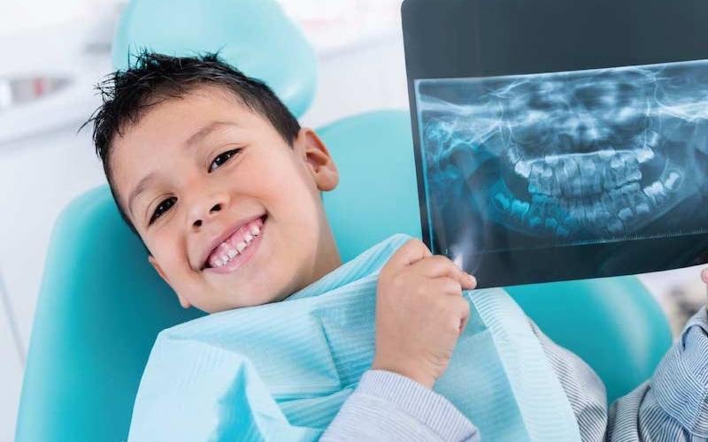 Chụp phim X-quang tổng thể răng hàm mặt trước khi niềng răng