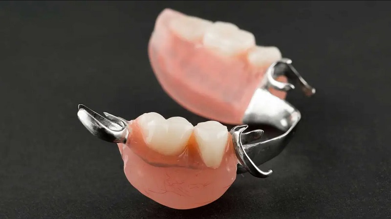 Răng tạm thời có tuổi thọ tương đối ngắn, được sử dụng trong thời gian chờ lắp răng giả vĩnh viễn, giúp đảm bảo khả năng ăn nhai và thẩm mỹ hàm răng