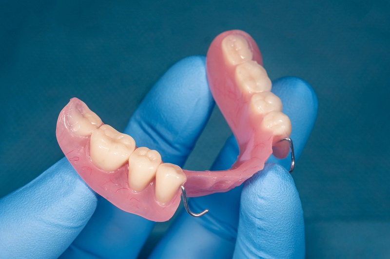 Răng giả tạm giúp bảo vệ nướu răng và đảm bảo tính thẩm mỹ của hàm răng trong thời gian bọc răng sứ hoặc trồng răng Implant