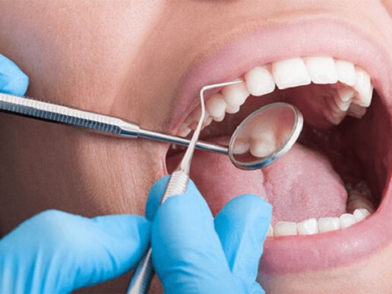 Kỹ thuật lấy cao răng sai cách sẽ làm tổn thương nướu và răng, gây ra tình trạng ê buốt