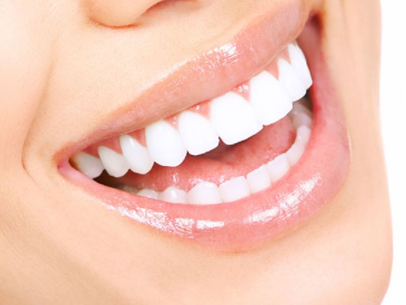 Bọc răng sứ thẩm mỹ giúp hàm răng đẹp và trắng sáng