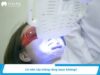 Tẩy trắng răng bằng Laser là gì? Giá bao nhiêu tiền một lần?