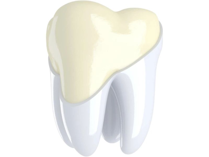 Kỹ thuật trám men răng sử dụng vật liệu lành tính nên không gây hại tới men răng